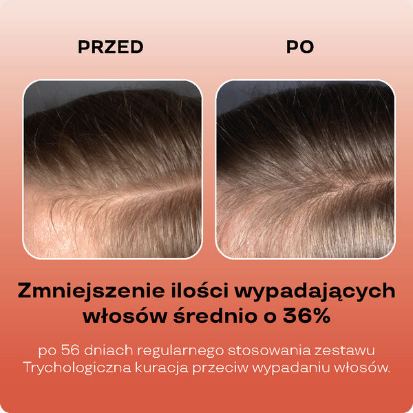 Stymulujący szampon przeciw wypadaniu włosów, 3% niacynamidu, witamina B6, fermentowany ekstrakt z żeń-szenia